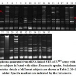  Figure 1: Amplicons generated from tRNA-linked STR of RTCT array with R-R5/R-R3 primers for subjects infected with either Entamoeba species. Click here to View figure