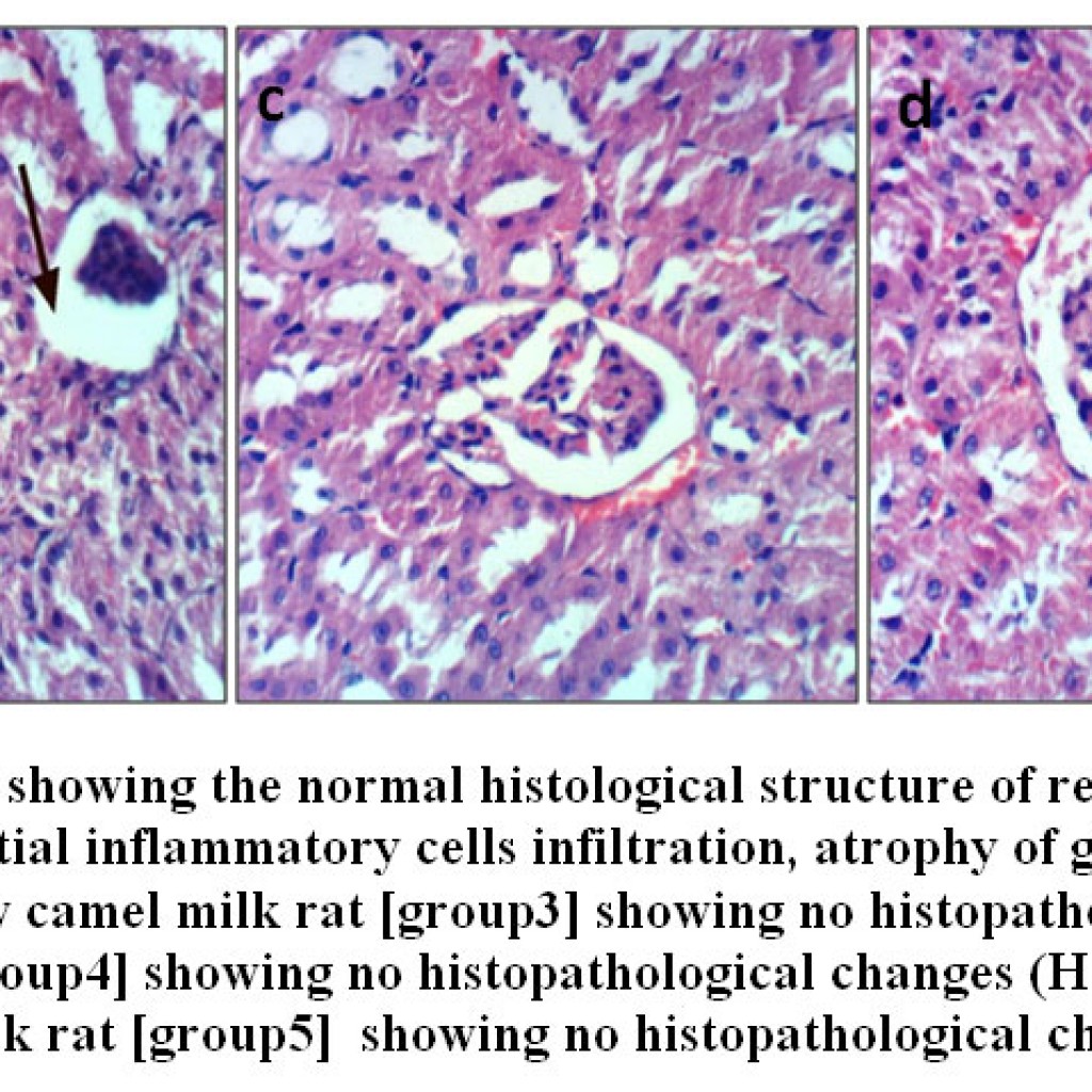 Impact of Camel’s Milk on Aluminum Chloride (Alcl3) – Induced Toxicity ...