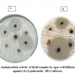 Figure 3: Antimicrobial activity of Kohl samples by agar well diffusion method against (A) S.epidermidis (B) C.albicans