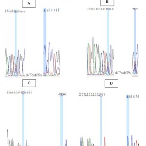 Apolipoprotein E Polymorphism and Alzheimer’s Risk in Kashmiri ...