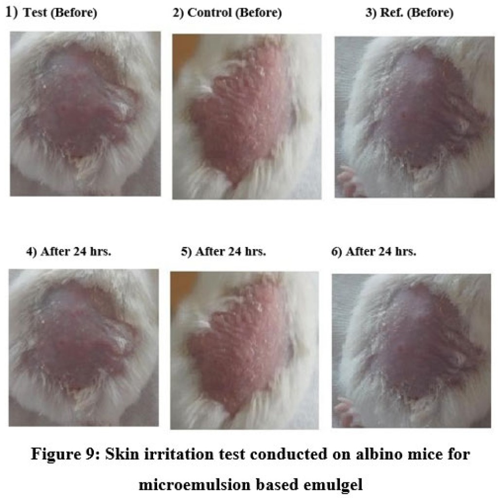 Formulation Development and Evaluation of Microemulsion Based ...