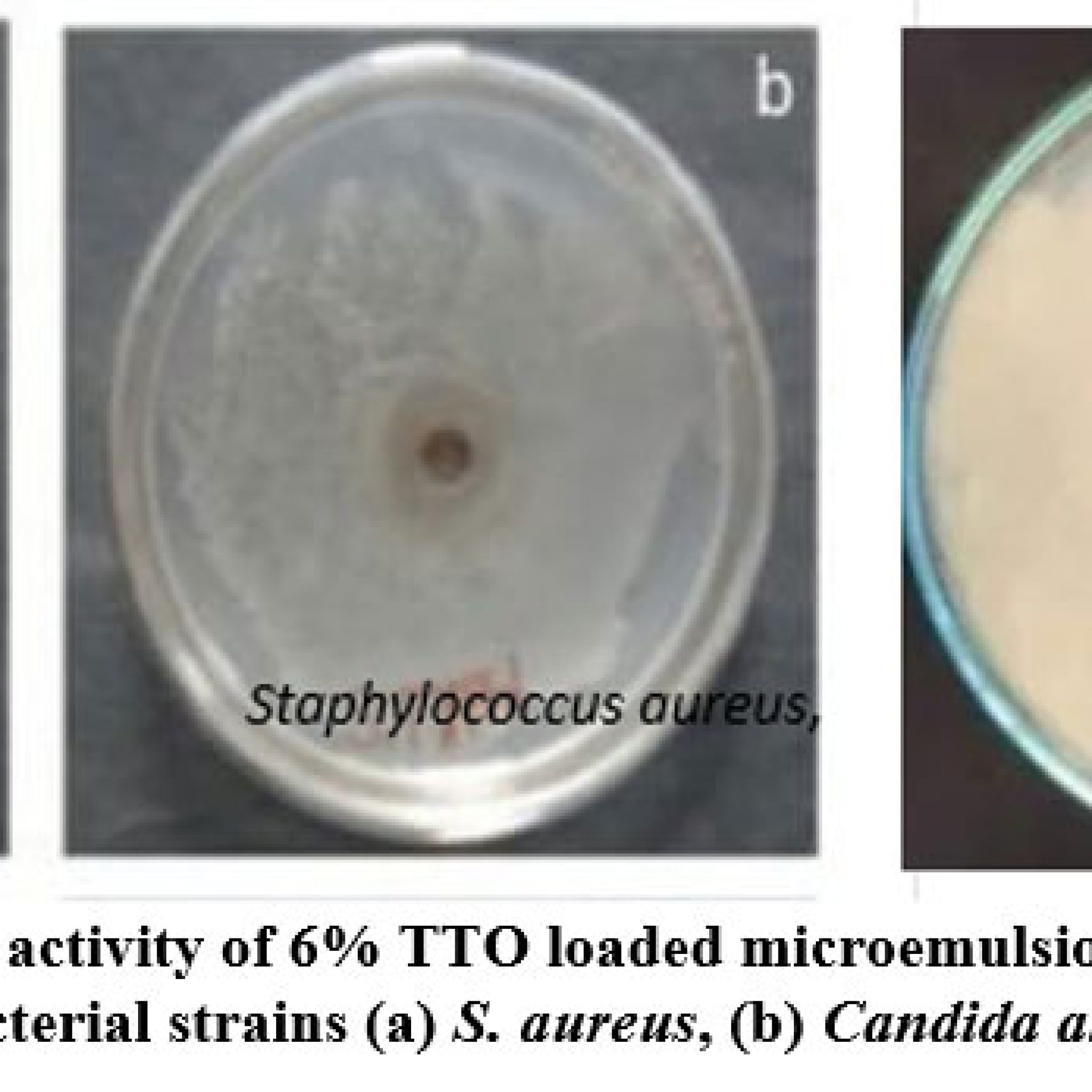 Formulation and Evaluation of Tea tree/ Rosemary Essential oil-based ...