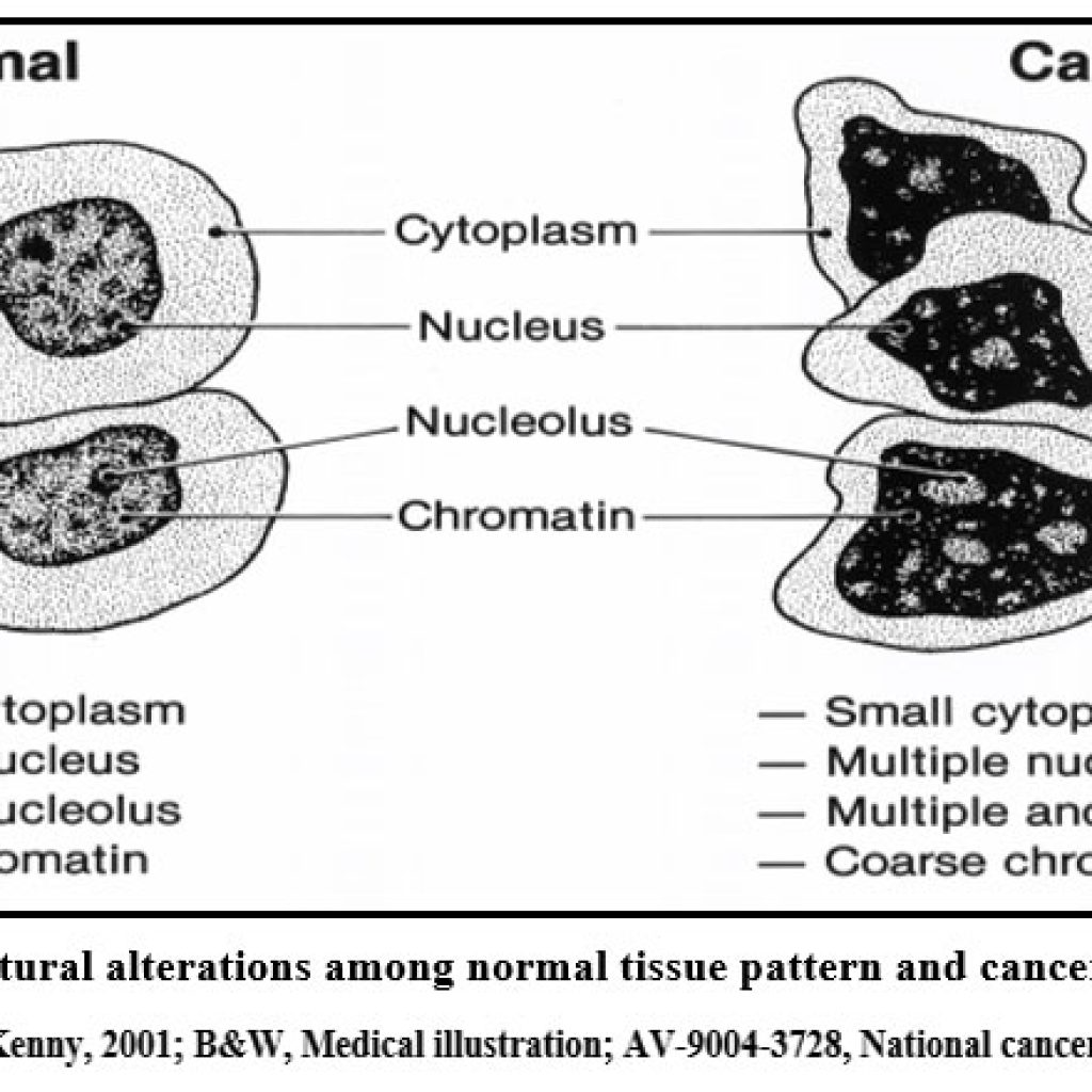 A Short Review – Biochemical Aspects and Advancements in Gastric Cancer ...