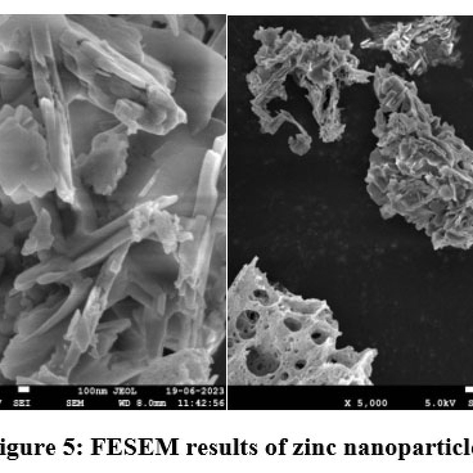 Zinc Nanoparticles and Nanocomposite Membrane Synthesized Using Leaves ...